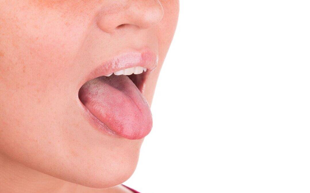 Tongue Scraping: What Are the Benefits?